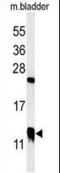 Cysteine Rich Protein 1 antibody, LS-B13196, Lifespan Biosciences, Western Blot image 