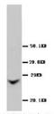 Gap Junction Protein Beta 2 antibody, AP23307PU-N, Origene, Western Blot image 