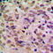CDKN2A antibody, LS-C351999, Lifespan Biosciences, Immunohistochemistry paraffin image 