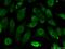 ERCC Excision Repair 1, Endonuclease Non-Catalytic Subunit antibody, 66275-1-Ig, Proteintech Group, Immunofluorescence image 