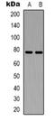 Centrosomal Protein 78 antibody, orb318808, Biorbyt, Western Blot image 