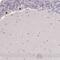 Kelch Repeat And BTB Domain Containing 6 antibody, HPA046861, Atlas Antibodies, Immunohistochemistry frozen image 