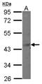 MAGE Family Member B6 antibody, LS-C155663, Lifespan Biosciences, Western Blot image 