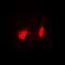 Sjoegren syndrome nuclear autoantigen 1 antibody, orb341398, Biorbyt, Immunofluorescence image 