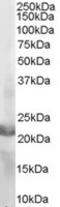 Rac Family Small GTPase 2 antibody, TA302763, Origene, Western Blot image 