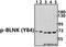 BLNK antibody, A03630Y84, Boster Biological Technology, Western Blot image 