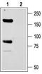 Amiloride-sensitive cation channel 2, neuronal antibody, TA329037, Origene, Western Blot image 