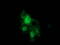 Catenin Beta 1 antibody, LS-C337243, Lifespan Biosciences, Immunofluorescence image 