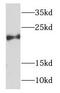 NADH:Ubiquinone Oxidoreductase Subunit B7 antibody, FNab05624, FineTest, Western Blot image 
