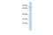 Zinc Finger Protein 354A antibody, PA5-68594, Invitrogen Antibodies, Western Blot image 