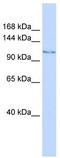 Lysine Demethylase 7A antibody, TA344417, Origene, Western Blot image 