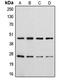 CD28 antibody, GTX55086, GeneTex, Western Blot image 