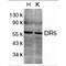 TNF Receptor Superfamily Member 10b antibody, TA305974, Origene, Western Blot image 
