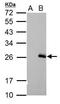 Regulator Of G Protein Signaling 17 antibody, TA308384, Origene, Western Blot image 