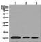 Barrier To Autointegration Factor 1 antibody, ab129184, Abcam, Western Blot image 