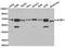 Insulin Like Growth Factor 2 MRNA Binding Protein 1 antibody, TA327060, Origene, Western Blot image 