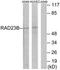 RAD23 Homolog B, Nucleotide Excision Repair Protein antibody, TA314415, Origene, Western Blot image 