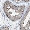 P-LAP antibody, HPA020996, Atlas Antibodies, Immunohistochemistry paraffin image 