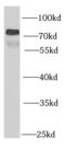 Pregnancy Specific Beta-1-Glycoprotein 1 antibody, FNab06855, FineTest, Western Blot image 