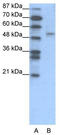 Forkhead Box D2 antibody, TA329396, Origene, Western Blot image 