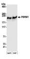 Protein polybromo-1 antibody, A700-019, Bethyl Labs, Western Blot image 