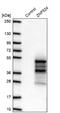 Zinc Finger Protein 524 antibody, NBP2-13579, Novus Biologicals, Western Blot image 