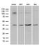 DnaJ Heat Shock Protein Family (Hsp40) Member B5 antibody, LS-C795666, Lifespan Biosciences, Western Blot image 