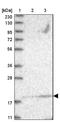 Ubiquitin Conjugating Enzyme E2 F (Putative) antibody, NBP1-92169, Novus Biologicals, Western Blot image 