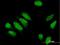 Phosphodiesterase 4D Interacting Protein antibody, H00009659-B01P, Novus Biologicals, Immunofluorescence image 