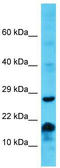 Membrane Spanning 4-Domains A6E antibody, TA331660, Origene, Western Blot image 