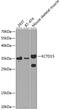 BTB/POZ domain-containing protein KCTD15 antibody, GTX32690, GeneTex, Western Blot image 