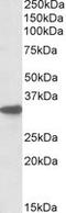 Cytochrome B5 Reductase 3 antibody, TA305933, Origene, Western Blot image 