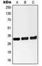 Nanog Homeobox Retrogene P8 antibody, orb215423, Biorbyt, Western Blot image 