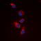 Eukaryotic translation initiation factor 4 gamma 1 antibody, abx133143, Abbexa, Western Blot image 