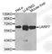 La Ribonucleoprotein Domain Family Member 7 antibody, A5983, ABclonal Technology, Western Blot image 