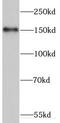 ERCC Excision Repair 6, Chromatin Remodeling Factor antibody, FNab02836, FineTest, Western Blot image 