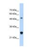 Immunoglobulin Superfamily Member 1 antibody, NBP1-59109, Novus Biologicals, Western Blot image 