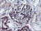 Schwannomin-interacting protein 1 antibody, M10758-1, Boster Biological Technology, Immunohistochemistry paraffin image 