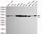 5-Aminoimidazole-4-Carboxamide Ribonucleotide Formyltransferase/IMP Cyclohydrolase antibody, GTX49205, GeneTex, Western Blot image 