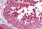 Heat Shock Protein Family A (Hsp70) Member 4 Like antibody, orb19830, Biorbyt, Immunohistochemistry paraffin image 