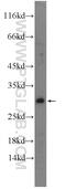 Protein FADD antibody, 14906-1-AP, Proteintech Group, Western Blot image 