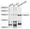 hIRAS antibody, STJ111485, St John