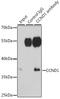Cyclin D1 antibody, LS-C331409, Lifespan Biosciences, Immunoprecipitation image 