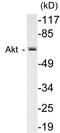 Autoimmune Regulator antibody, EKC1020, Boster Biological Technology, Western Blot image 