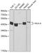 HLA class I histocompatibility antigen, A-1 alpha chain antibody, GTX54099, GeneTex, Western Blot image 