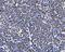 BUB1 Mitotic Checkpoint Serine/Threonine Kinase antibody, A00776-3, Boster Biological Technology, Immunohistochemistry paraffin image 