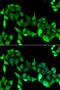 G Protein-Coupled Receptor Kinase 6 antibody, orb247403, Biorbyt, Immunofluorescence image 