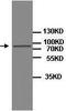 Eukaryotic Translation Initiation Factor 4E Nuclear Import Factor 1 antibody, TA310148, Origene, Western Blot image 