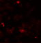 Rho-associated protein kinase 1 antibody, 6295, ProSci Inc, Immunofluorescence image 