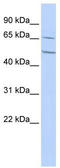 Cholinergic Receptor Nicotinic Alpha 4 Subunit antibody, TA338364, Origene, Western Blot image 